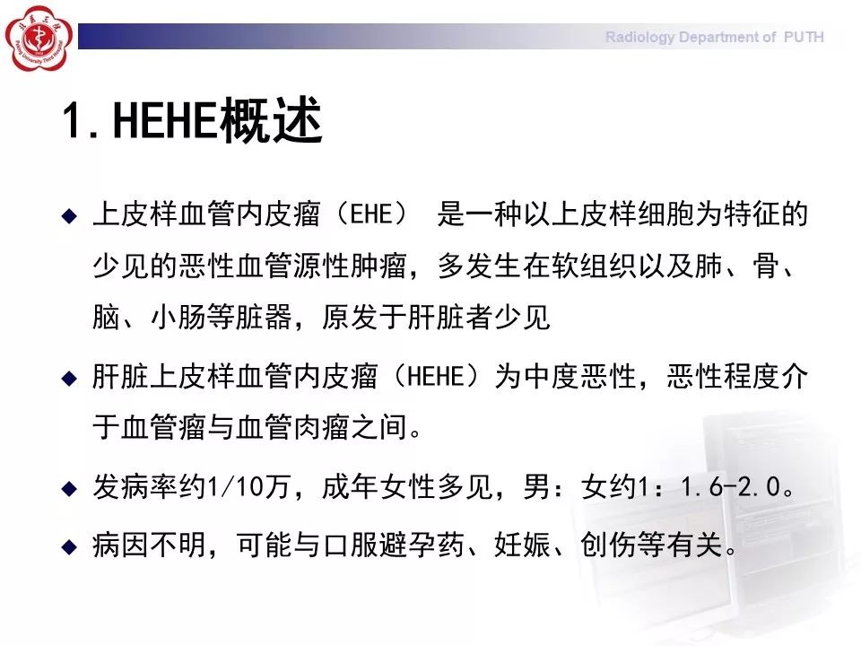 【病例】肝脏上皮样血管内皮瘤1例CT及MR