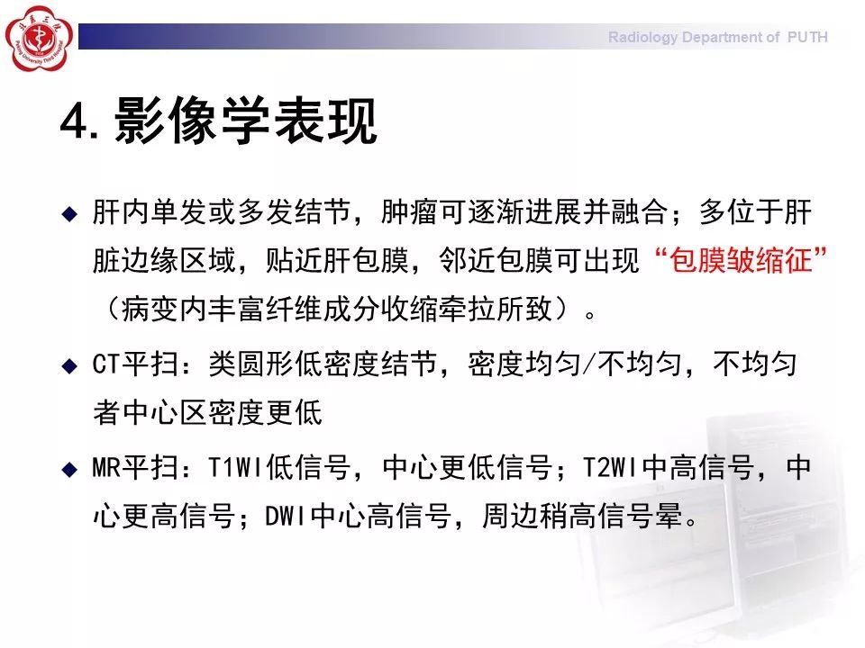【病例】肝脏上皮样血管内皮瘤1例CT及MR