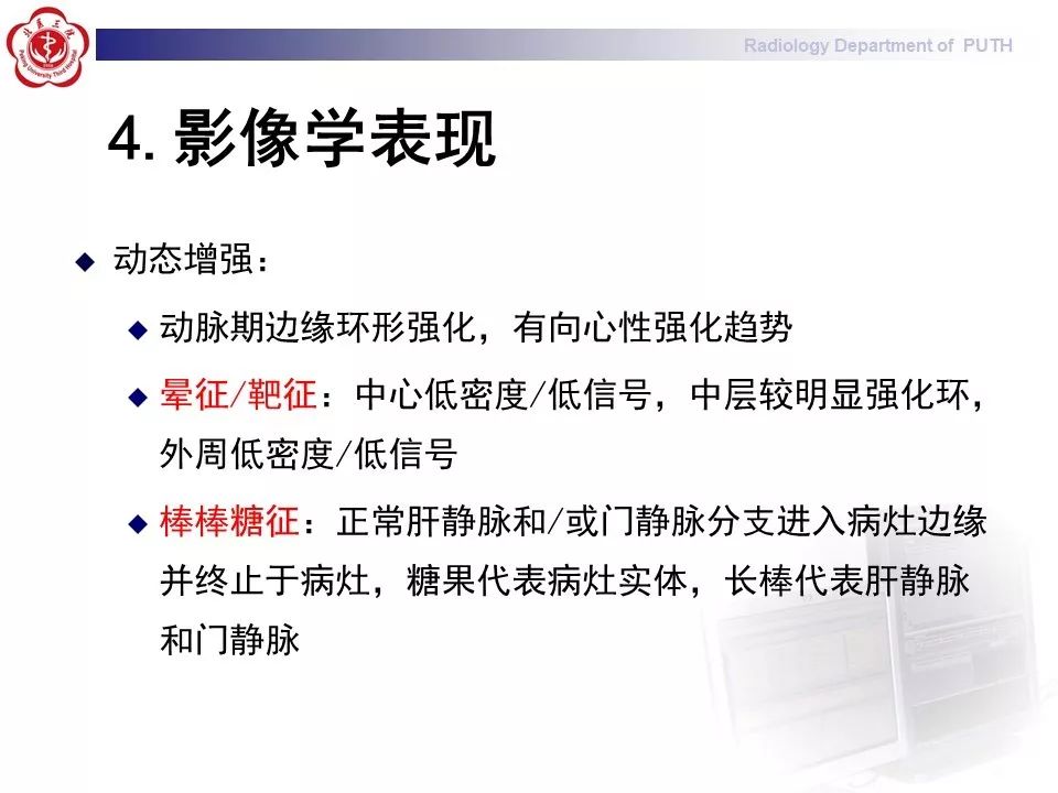 【病例】肝脏上皮样血管内皮瘤1例CT及MR