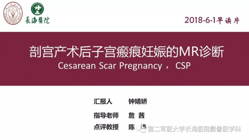 【PPT】剖宫产术后子宫瘢痕妊娠的MR诊断