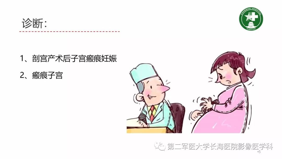【PPT】剖宫产术后子宫瘢痕妊娠的MR诊断