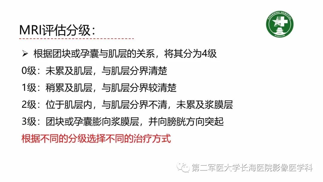 【PPT】剖宫产术后子宫瘢痕妊娠的MR诊断