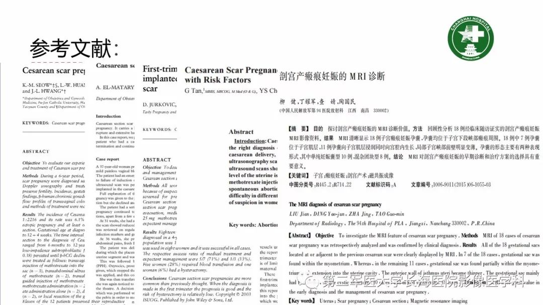 【PPT】剖宫产术后子宫瘢痕妊娠的MR诊断
