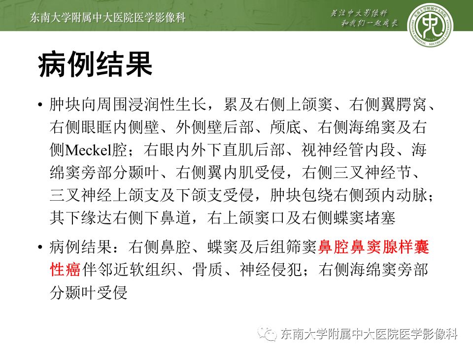 【PPT】三叉神经影像解剖及常见疾病