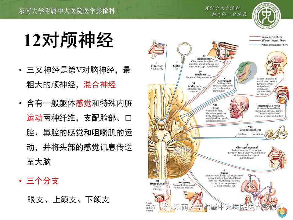 【PPT】三叉神经影像解剖及常见疾病