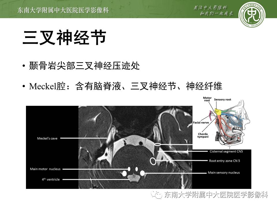 【PPT】三叉神经影像解剖及常见疾病