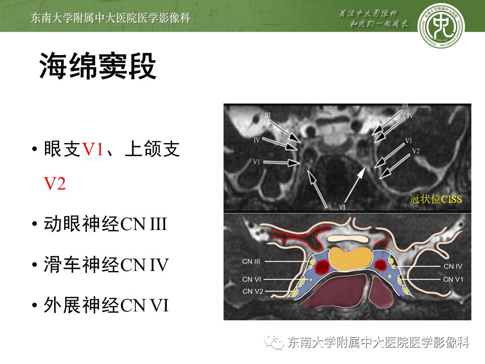【PPT】三叉神经影像解剖及常见疾病
