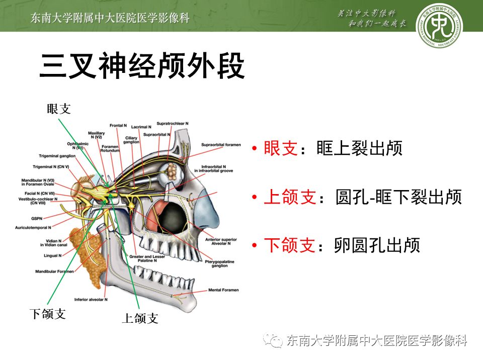 【PPT】三叉神经影像解剖及常见疾病