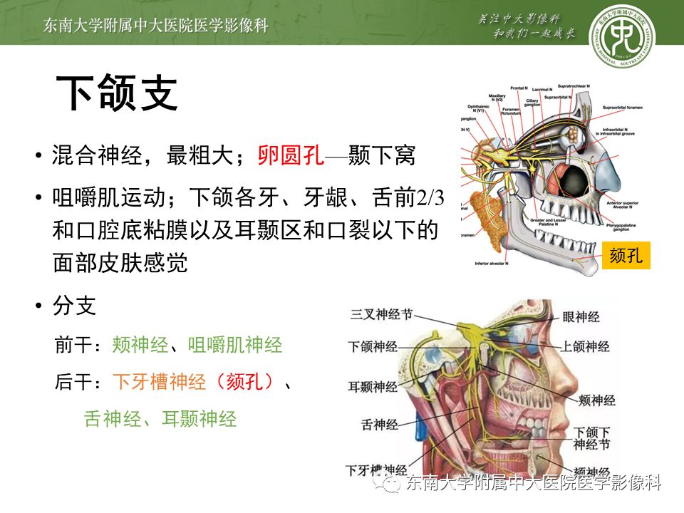【PPT】三叉神经影像解剖及常见疾病