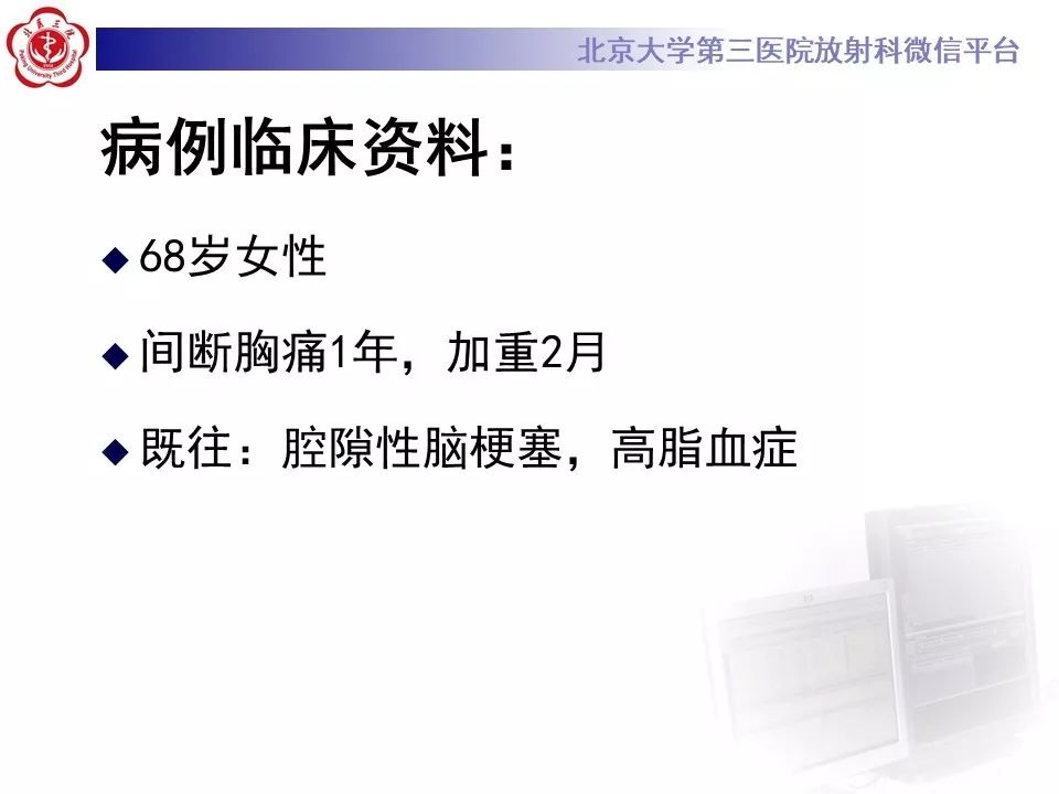 【PPT】心脏憩室