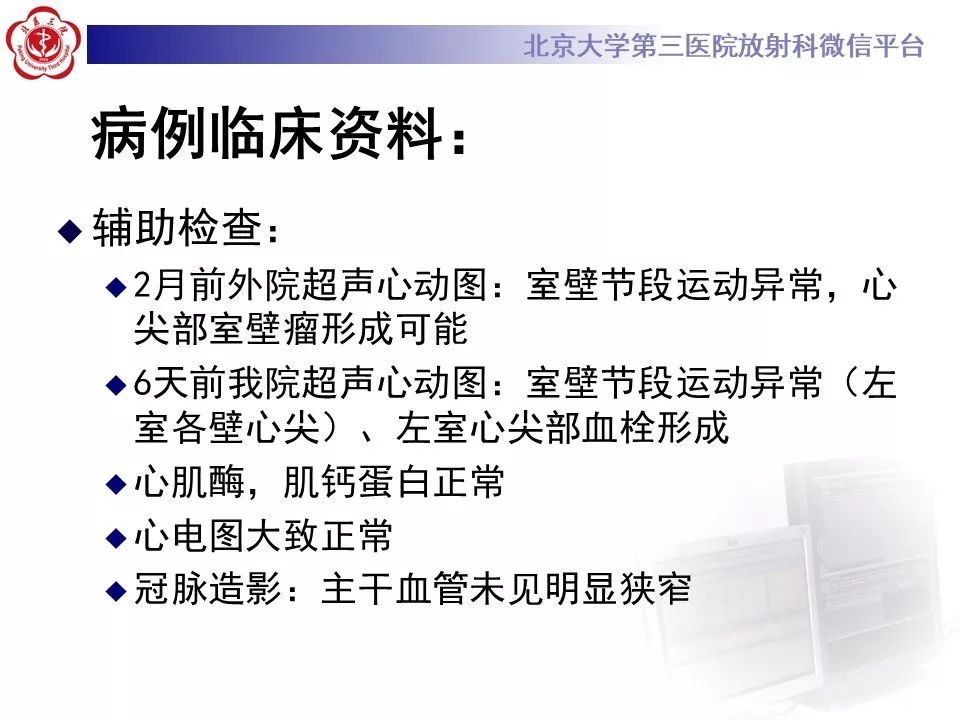 【PPT】心脏憩室