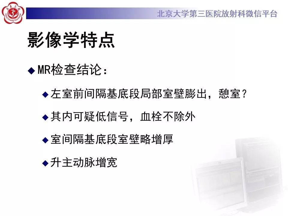 【PPT】心脏憩室