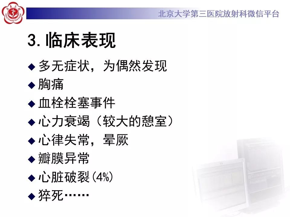 【PPT】心脏憩室