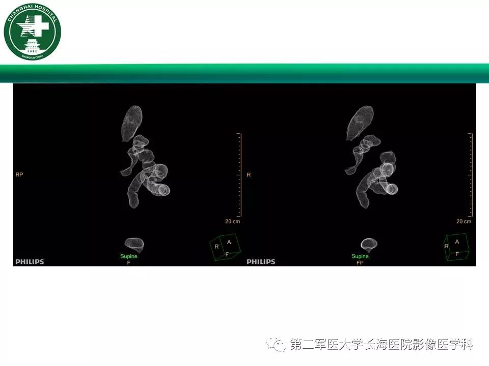 【PPT】CT结肠造影的临床应用