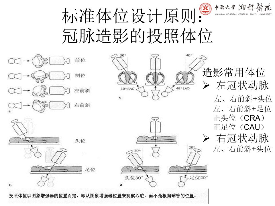 【PPT】湘雅冠脉CTA标准化后处理及规范化报告
