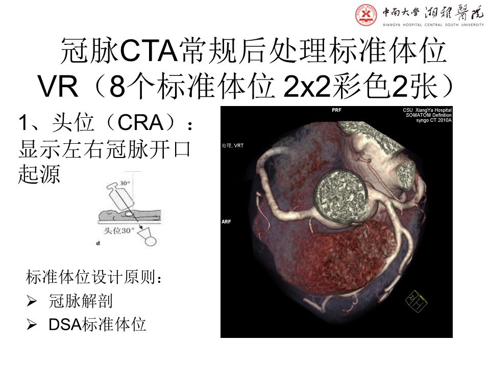 【PPT】湘雅冠脉CTA标准化后处理及规范化报告