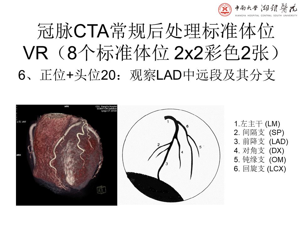 【PPT】湘雅冠脉CTA标准化后处理及规范化报告