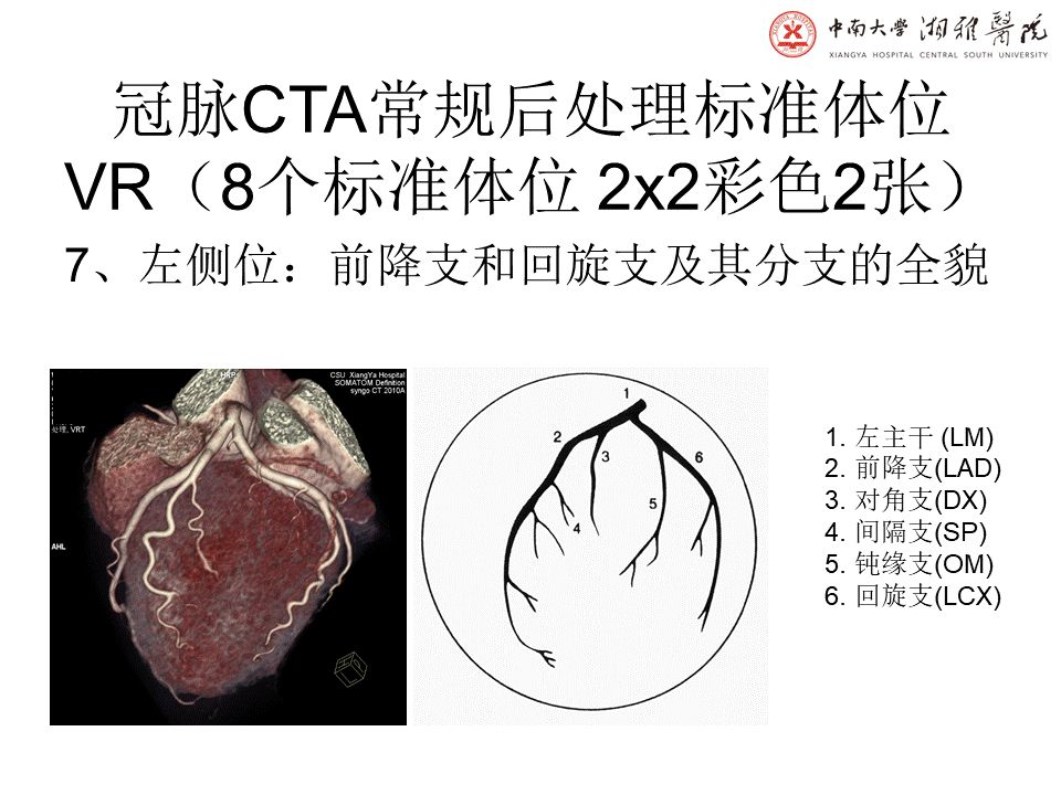【PPT】湘雅冠脉CTA标准化后处理及规范化报告