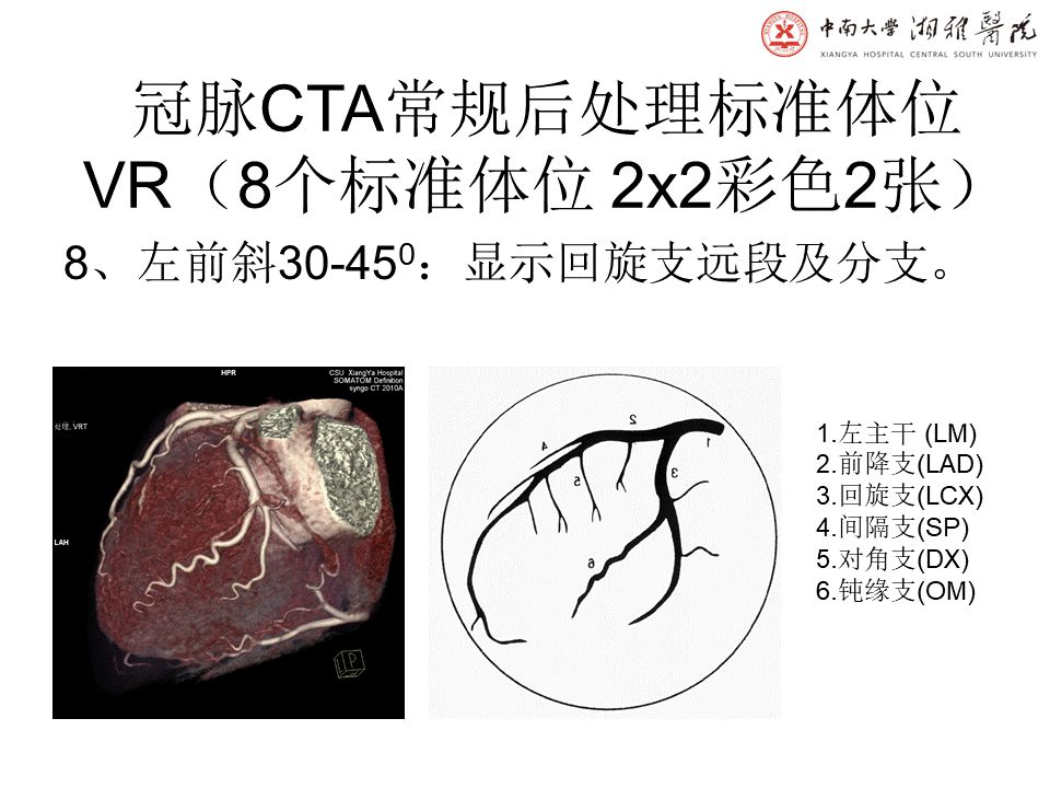 【PPT】湘雅冠脉CTA标准化后处理及规范化报告