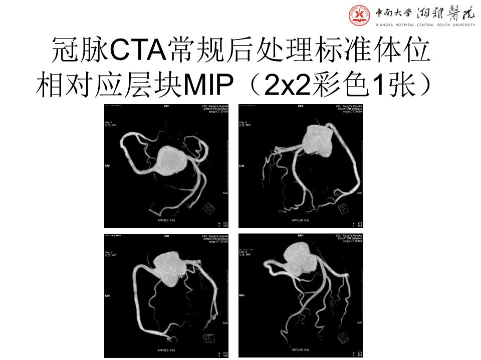 【PPT】湘雅冠脉CTA标准化后处理及规范化报告