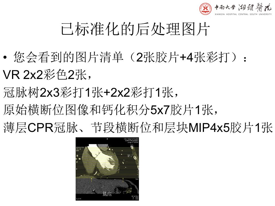 【PPT】湘雅冠脉CTA标准化后处理及规范化报告