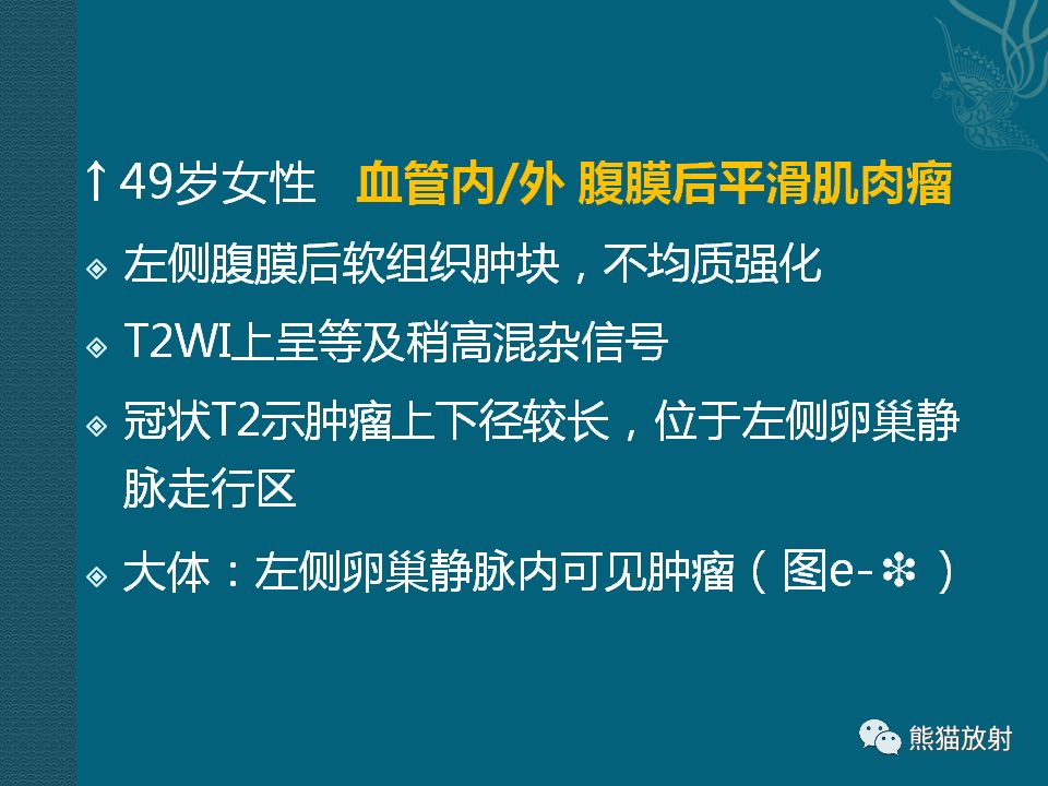 【PPT】腹膜后平滑肌肉瘤诊断及鉴别诊断