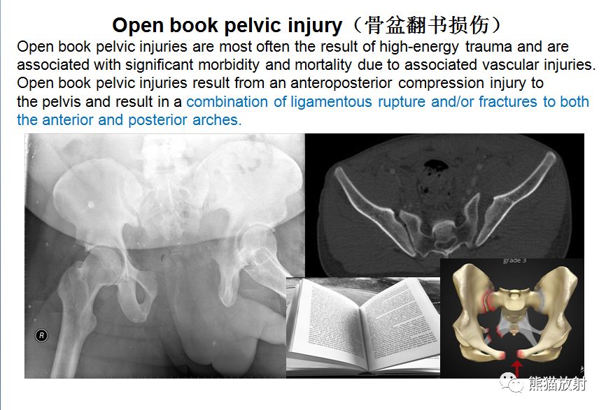 骨关节外伤特殊征象及名称 骨关节外伤特殊征象及名称