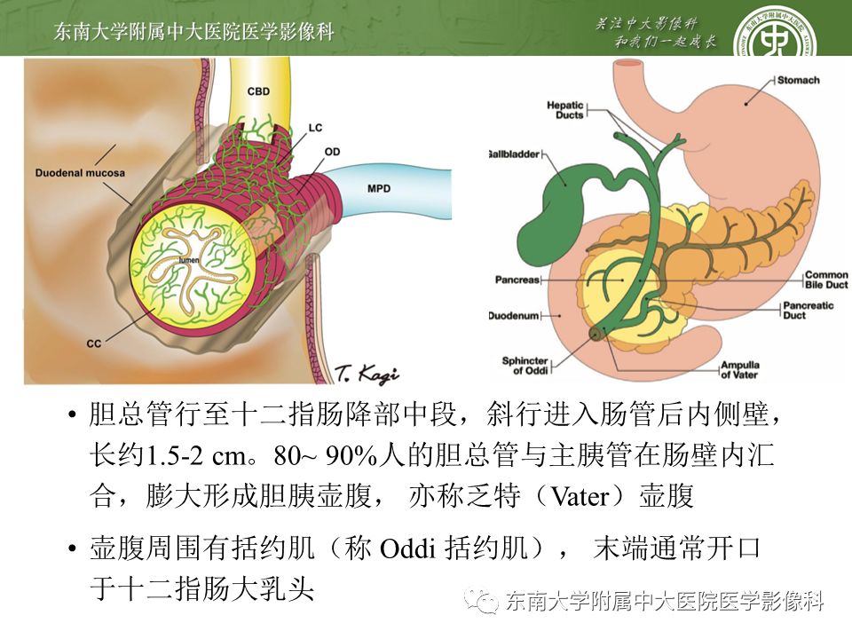【PPT】常见恶性胆道梗阻疾病影像学表现