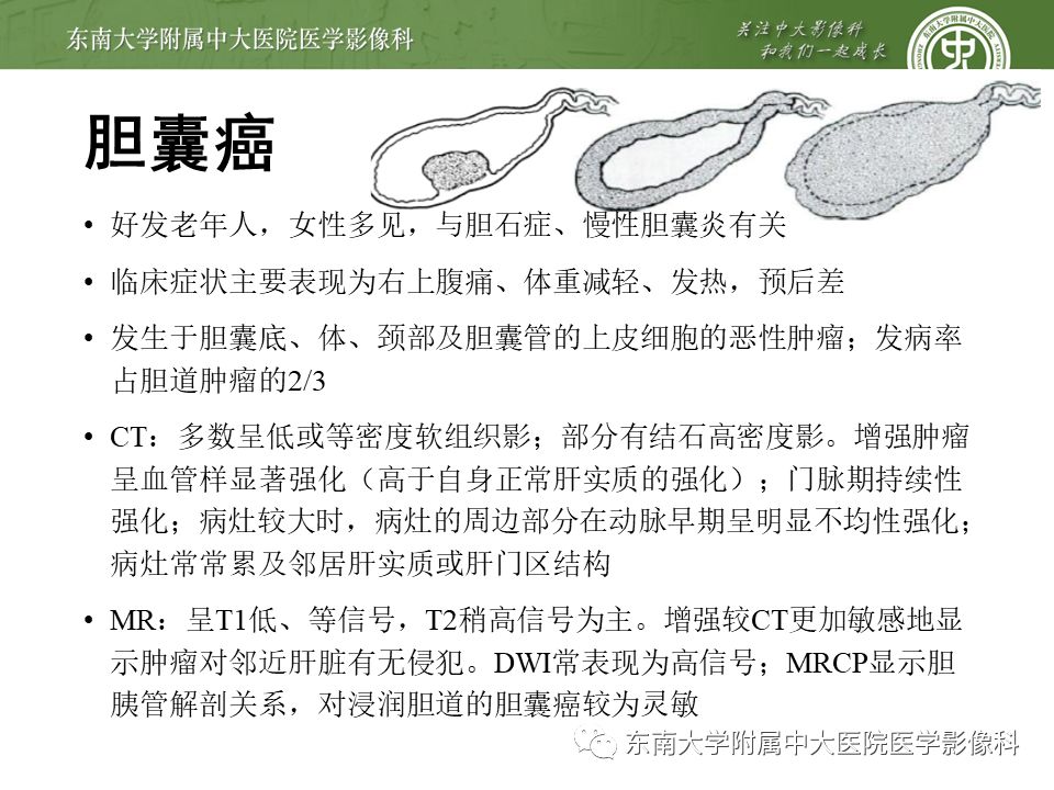 【PPT】常见恶性胆道梗阻疾病影像学表现