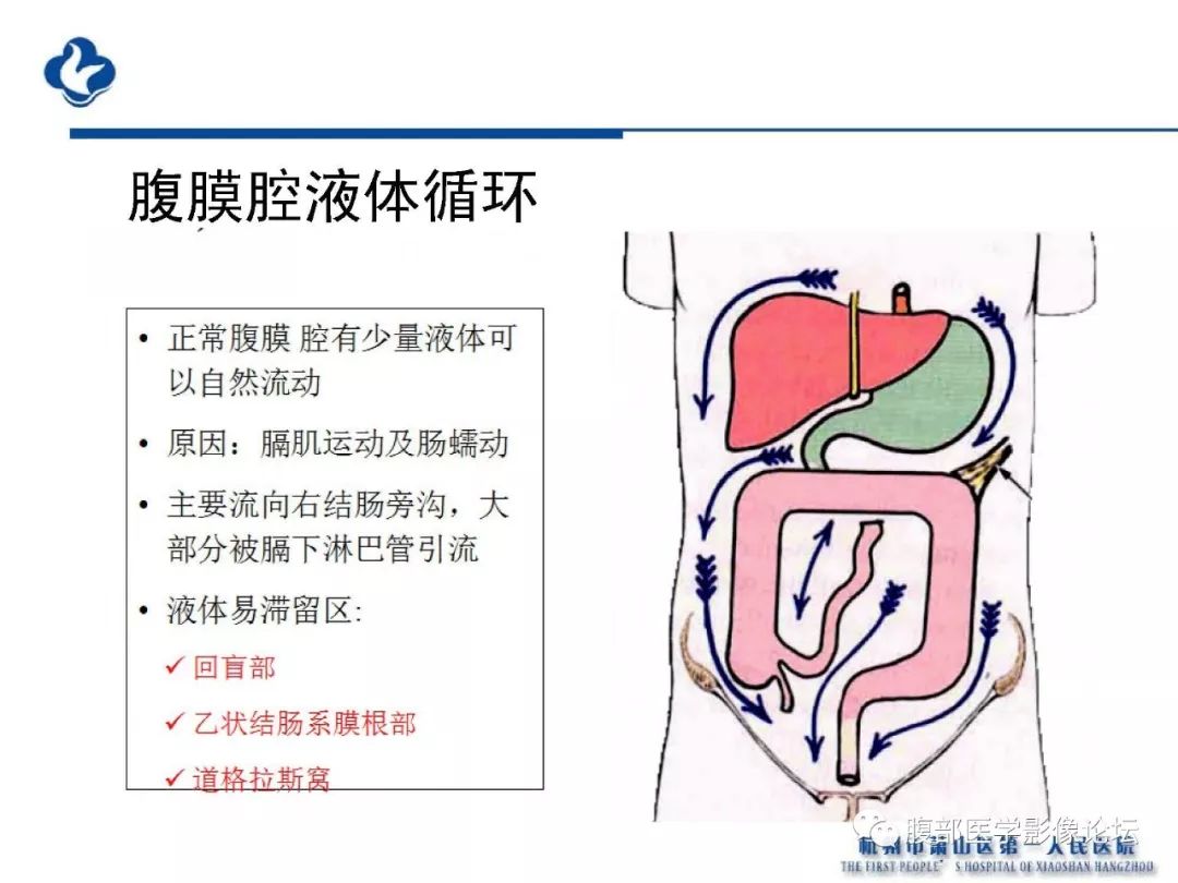 【PPT】胰腺炎病例复习—胰腺炎影像表现及并发症影像评估