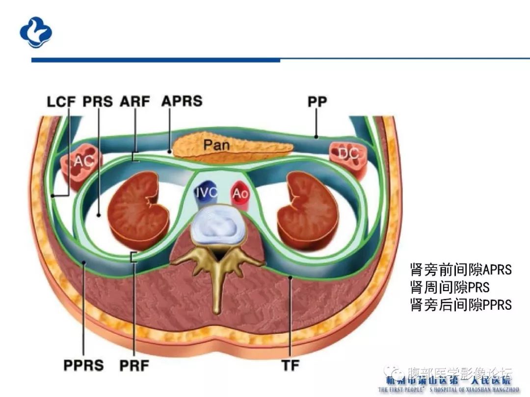 【PPT】胰腺炎病例复习—胰腺炎影像表现及并发症影像评估