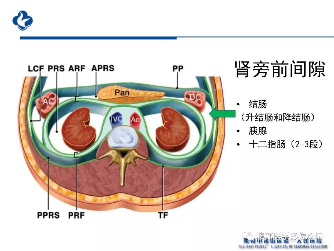 【PPT】胰腺炎病例复习—胰腺炎影像表现及并发症影像评估