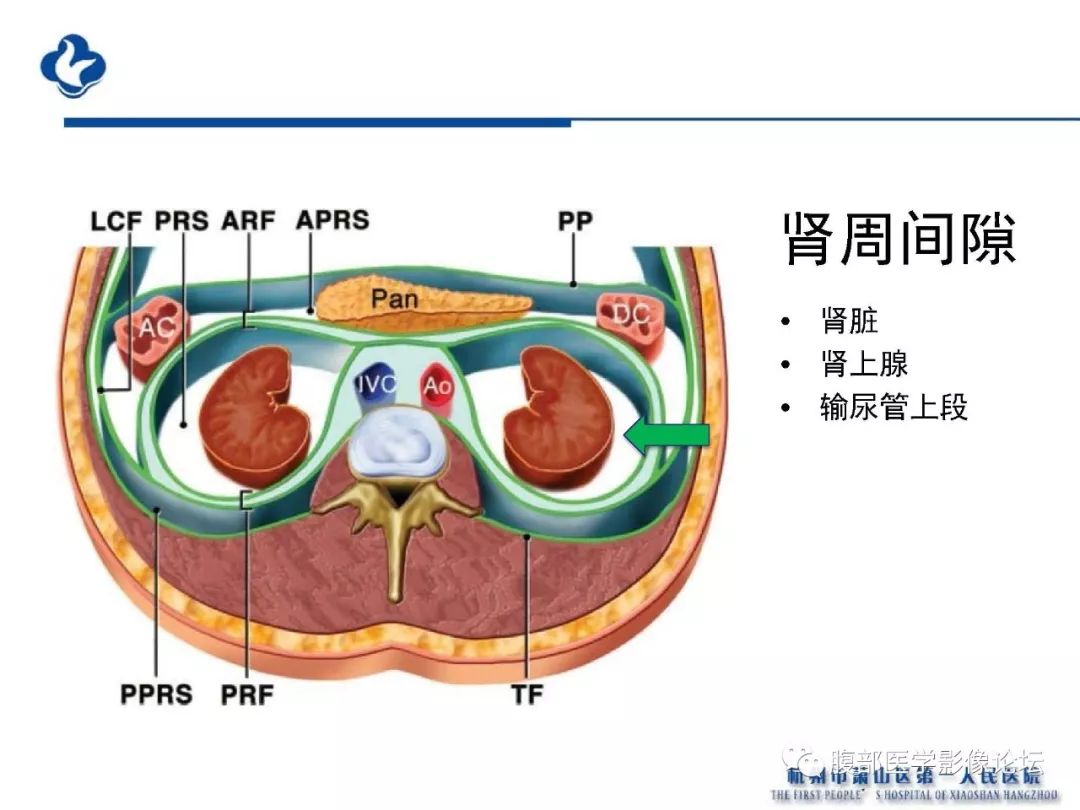 【PPT】胰腺炎病例复习—胰腺炎影像表现及并发症影像评估