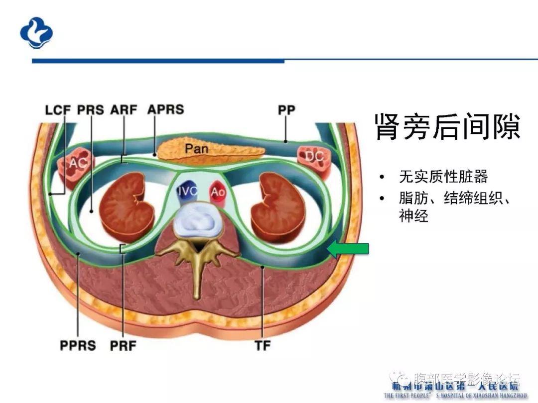 【PPT】胰腺炎病例复习—胰腺炎影像表现及并发症影像评估