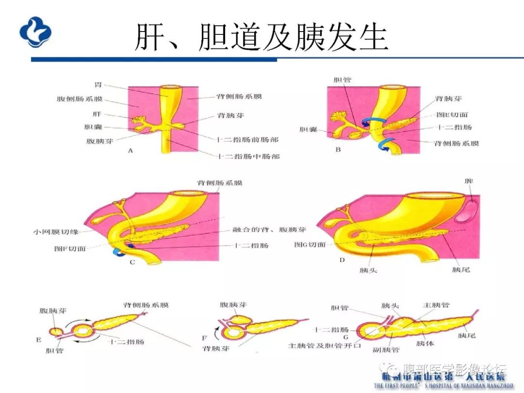 【PPT】胰腺炎病例复习—胰腺炎影像表现及并发症影像评估
