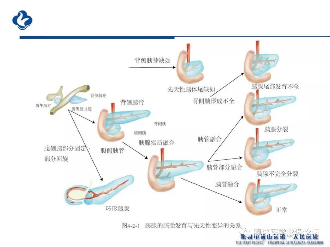 【PPT】胰腺炎病例复习—胰腺炎影像表现及并发症影像评估
