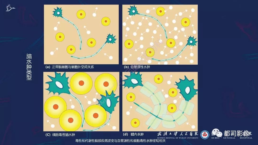 【PPT】中毒性及代谢性脑病影像诊断