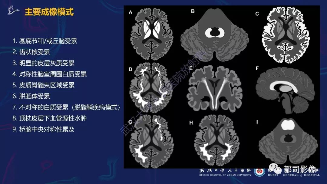 【PPT】中毒性及代谢性脑病影像诊断