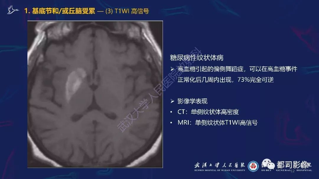 【PPT】中毒性及代谢性脑病影像诊断