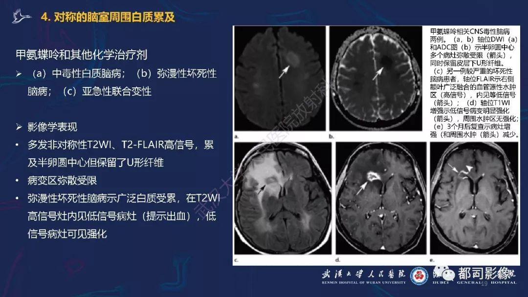 【PPT】中毒性及代谢性脑病影像诊断