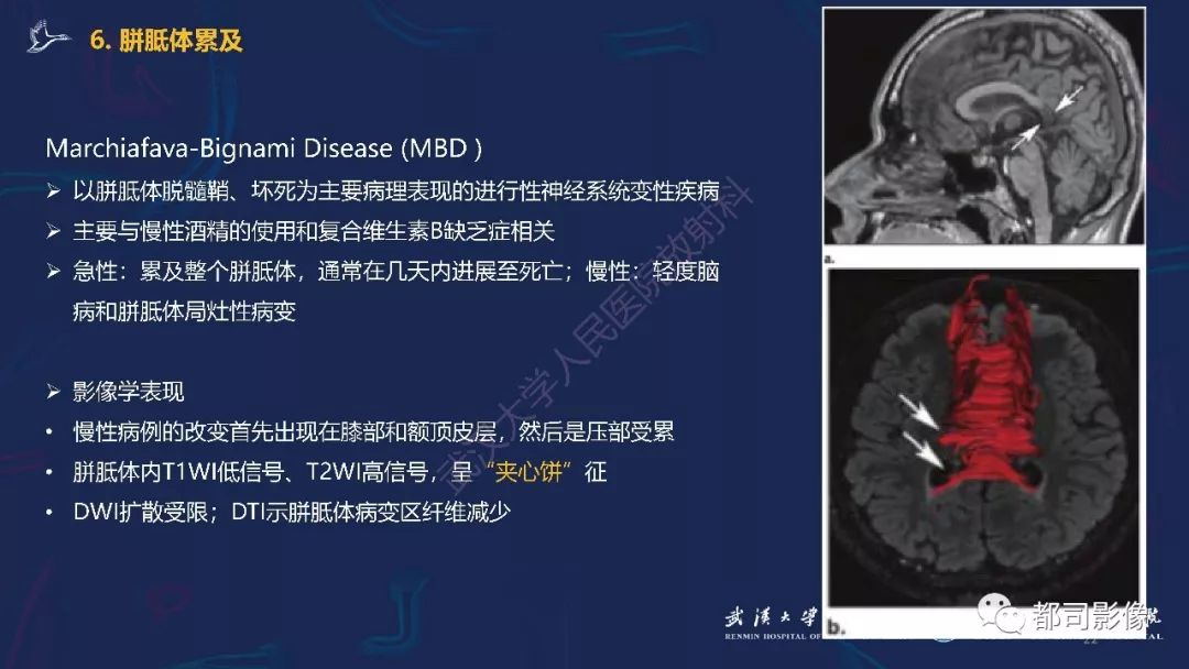 【PPT】中毒性及代谢性脑病影像诊断