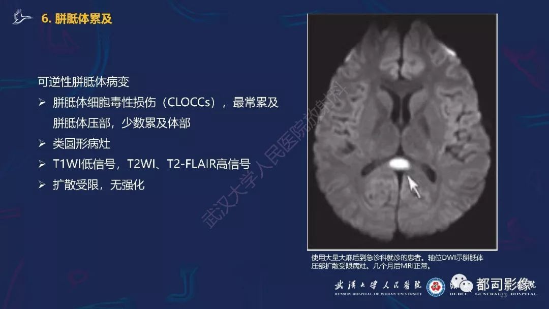 【PPT】中毒性及代谢性脑病影像诊断
