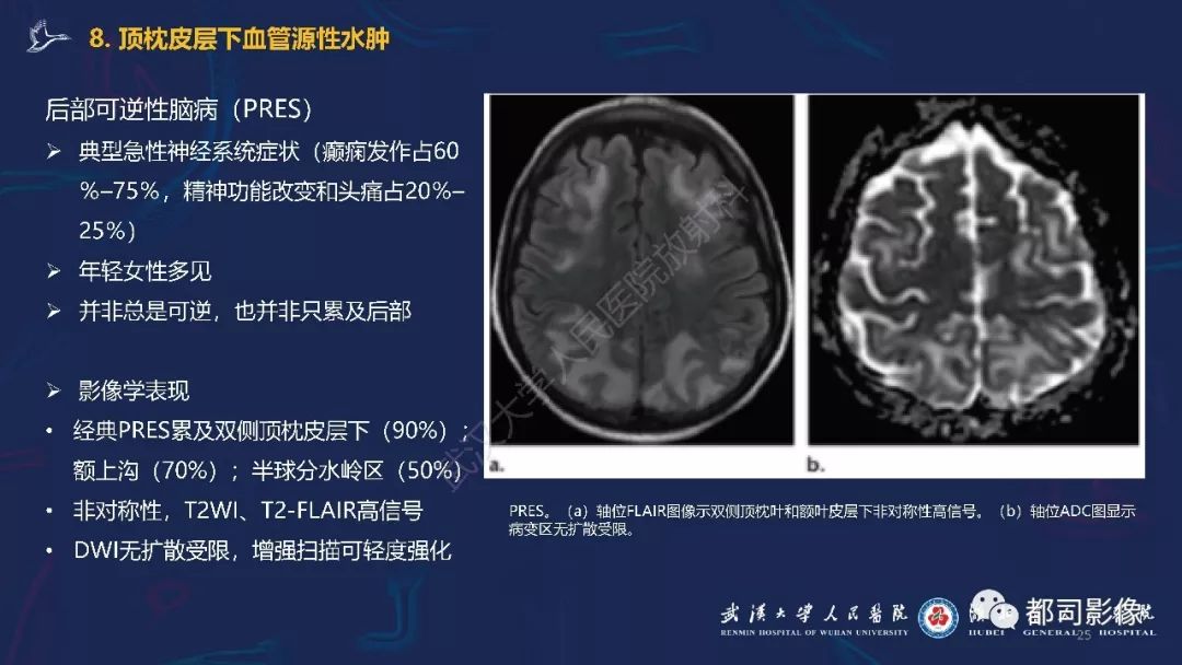 【PPT】中毒性及代谢性脑病影像诊断
