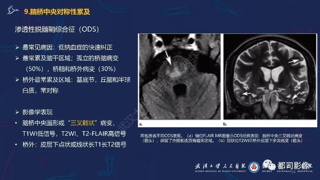 【PPT】中毒性及代谢性脑病影像诊断