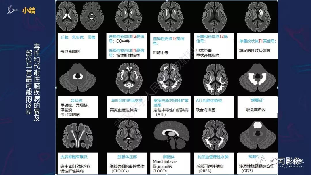 【PPT】中毒性及代谢性脑病影像诊断