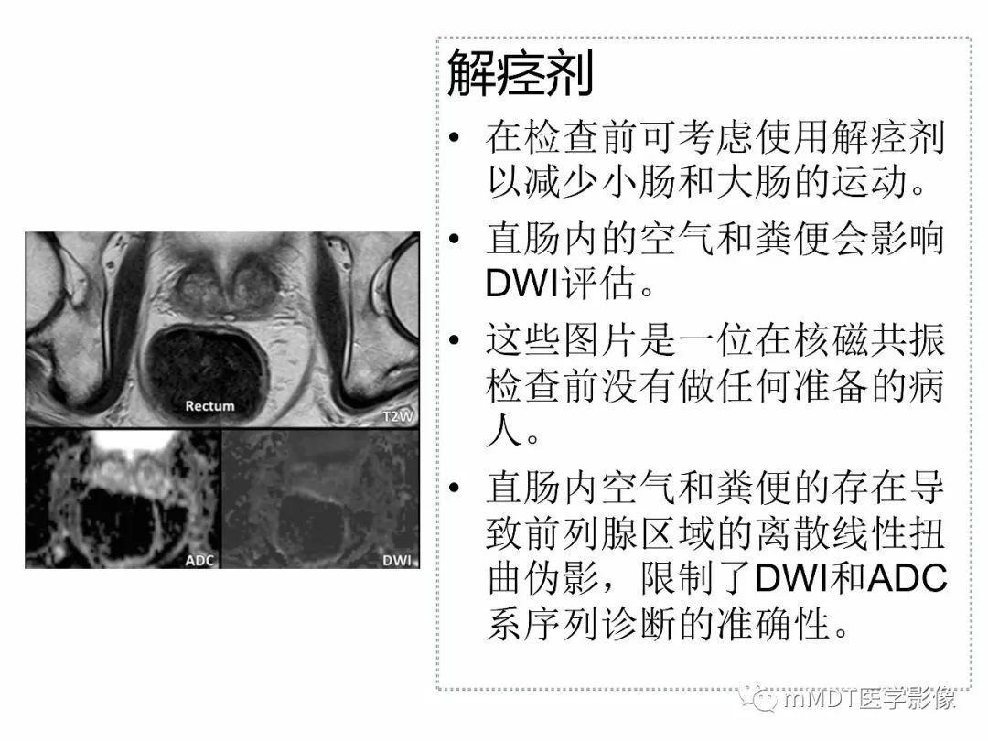 【PPT】前列腺癌：影像报告与数据系统（版本2）