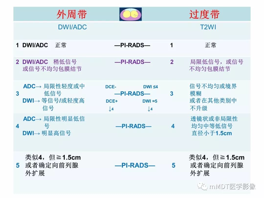 【PPT】前列腺癌：影像报告与数据系统（版本2）