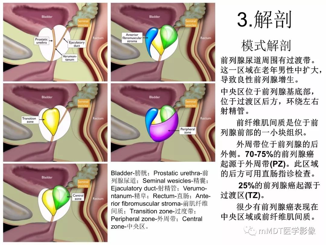 【PPT】前列腺癌：影像报告与数据系统（版本2）