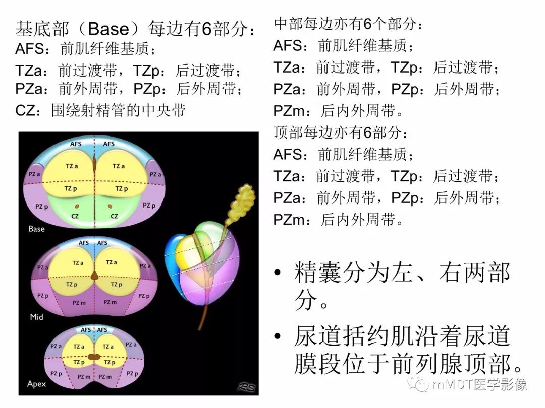 【PPT】前列腺癌：影像报告与数据系统（版本2）