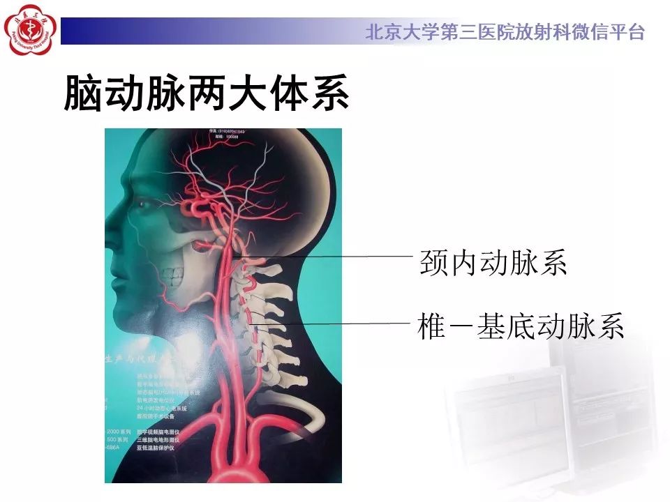【PPT】脑动脉解剖及供血区分布
